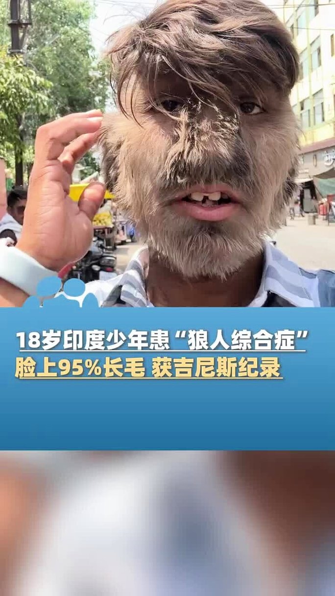 50岁老熟女超大尺度人体摄影的相关介绍